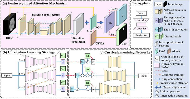 [NeuroComputing] ​FANCL: Feature-Guided Attention Network with Curriculum Learning for Brain Metastases Segmentation